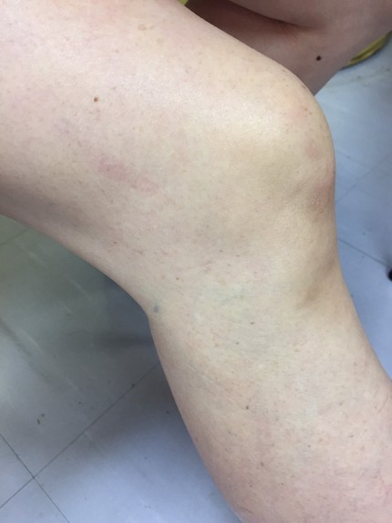 S__23396418 S__23396418