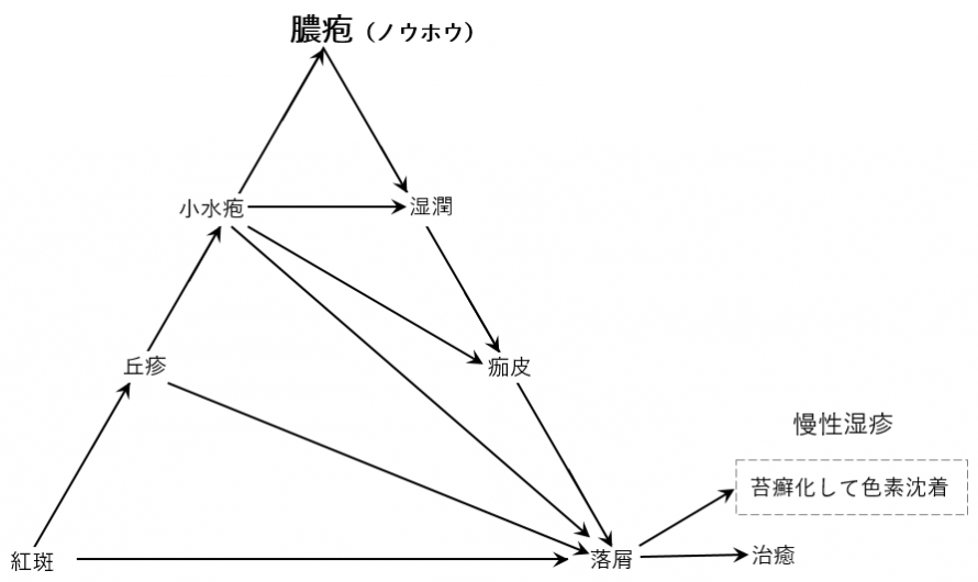 湿疹三角形